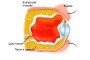 Anophthalmos | phthisis eye anatomy